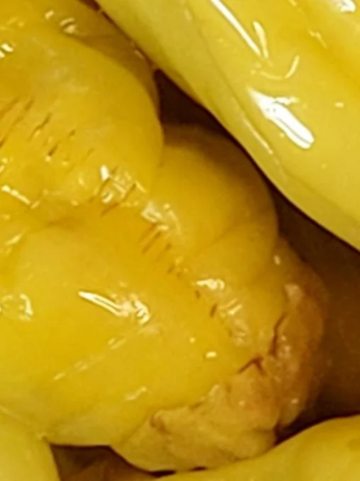 Pepperoncinis